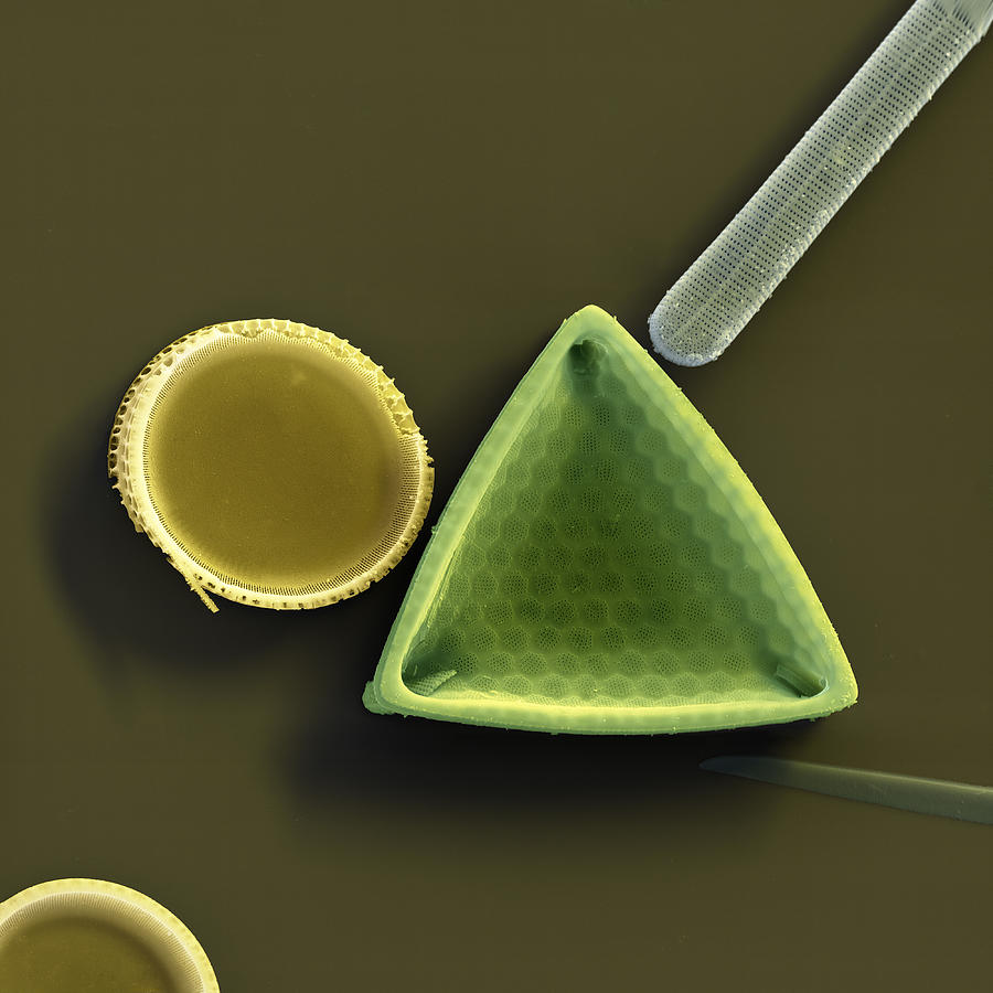 Diatoms Photograph by Meckes/ottawa