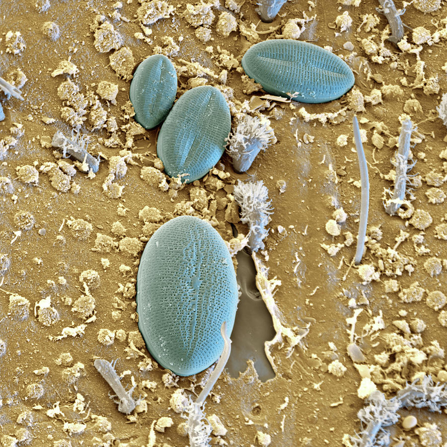 Diatoms On Mayfly Surface, Sem Photograph by Eye Of Science