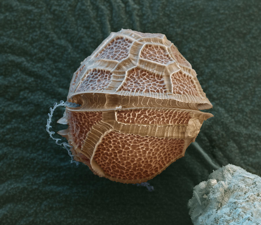 Dinoflagellate, Sem Photograph by Meckes/ottawa