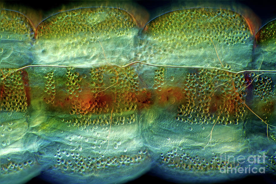 Diptera Larva Body Photograph by Marek Mis/science Photo Library