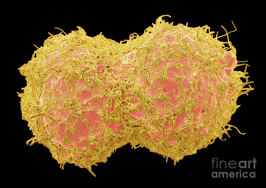 Dividing Breast Cancer Cells Photograph by Steve Gschmeissner/science Photo Library