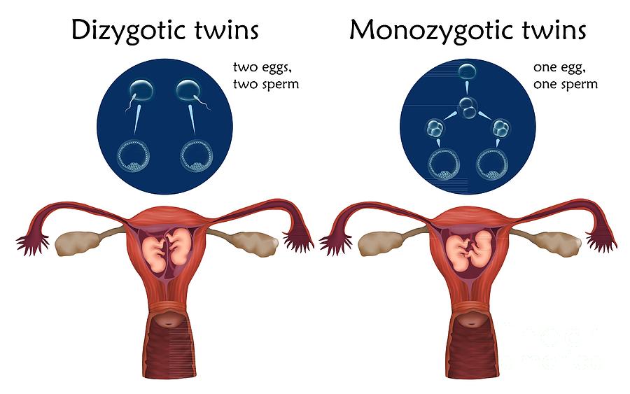 Dizygotic And Monozygotic Twins Photograph By Veronika Zakharovascience Photo Library 