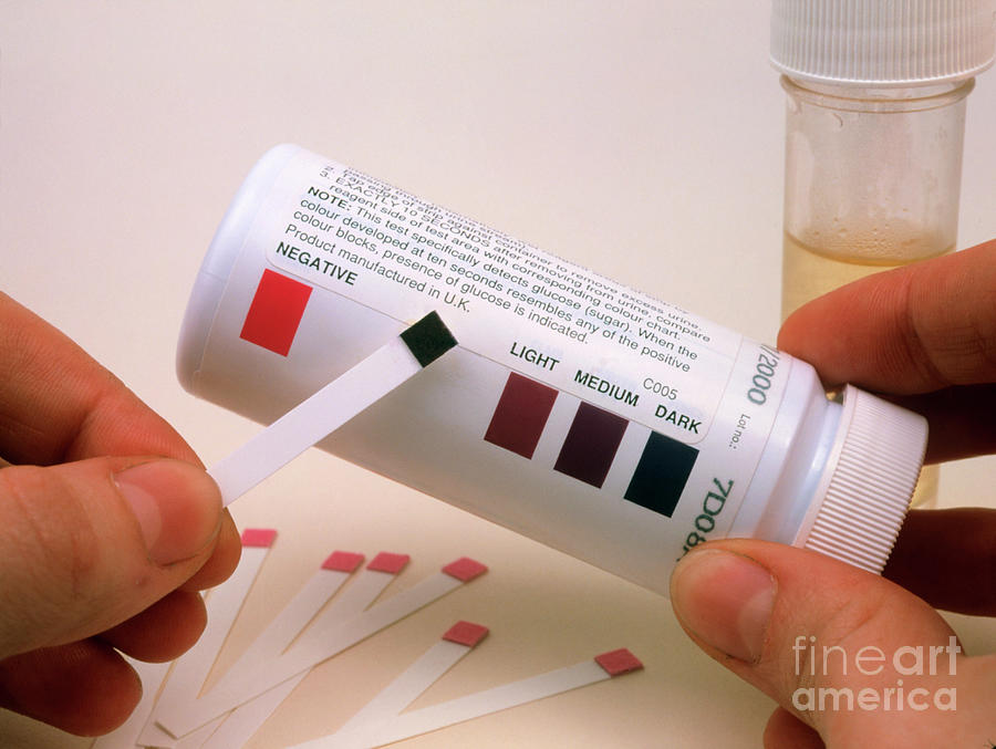 Doctor & Positive (abnormal) Clinistix Urine Test Photograph by Cordelia Molloy/science Photo Library