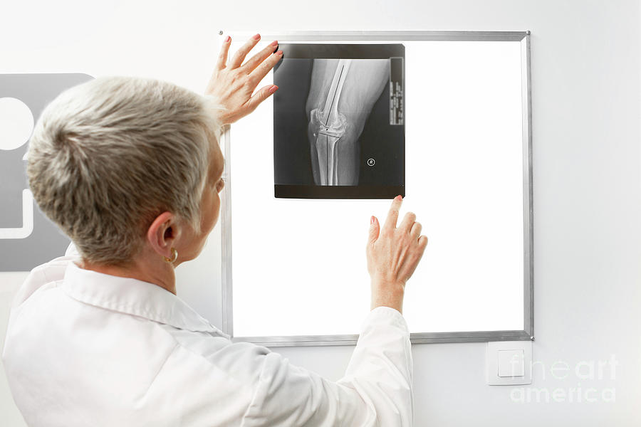 Doctor Examining Knee X-ray Photograph by Peakstock / Science Photo Library