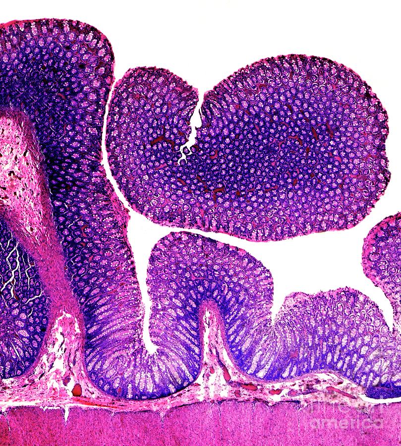 Dog Rectum Tissue Section by Nigel Downer/science Photo Library