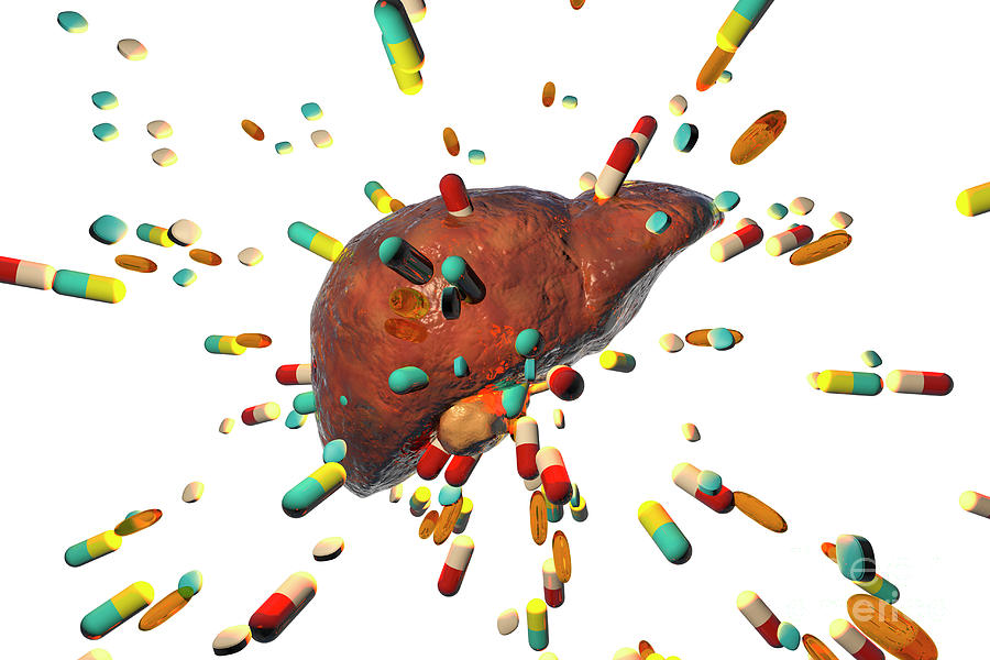 Drug-induced Hepatotoxicity By Kateryna Kon/science Photo Library