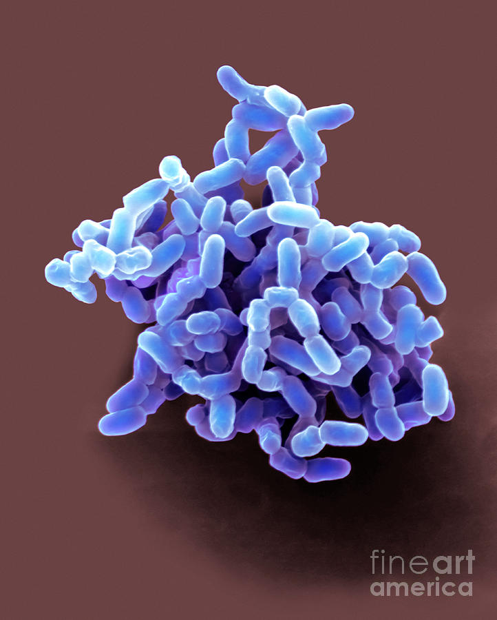 Drug-resistant Tuberculosis Bacteria Photograph by Dennis Kunkel Microscopy/science Photo Library