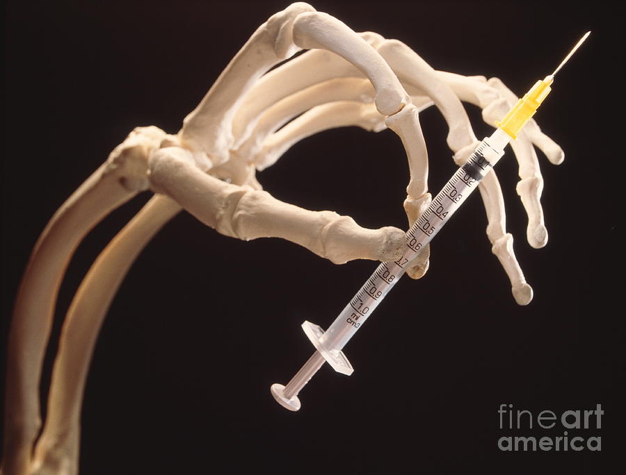 Drugs & Death: Hand Of Skeleton Holding A Syringe Photograph by Oscar Burriel/science Photo Library