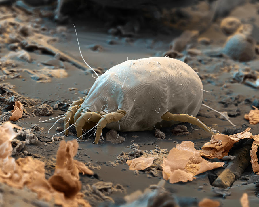 Dust Mite Photograph by Oliver Meckes EYE OF SCIENCE