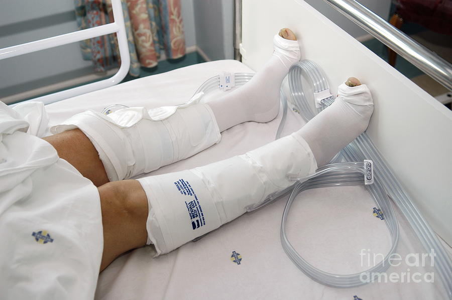 Dvt Stockings Photograph by Science Photo Library