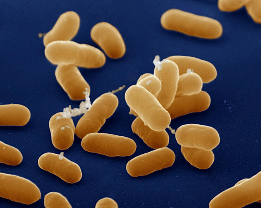 E. Coli Bacteria Photograph by Eye of Science