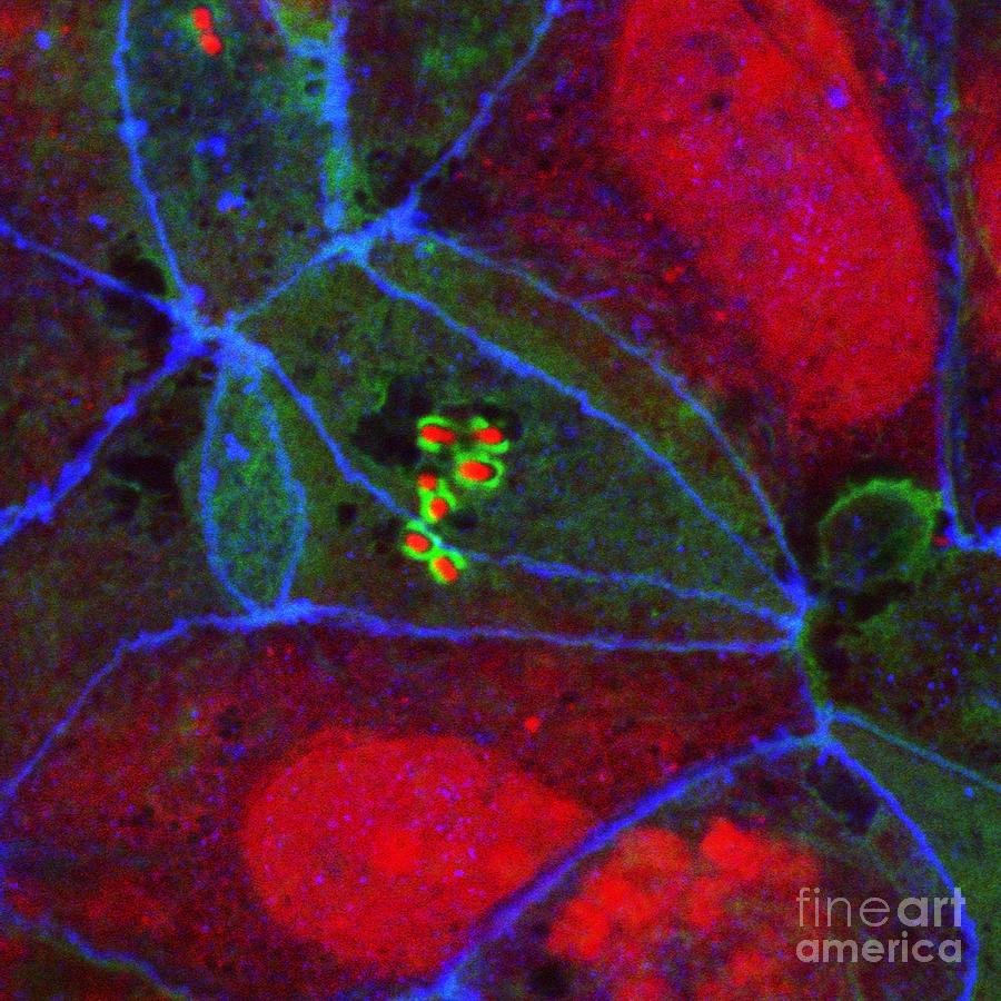 E. Coli Bacteria In Small Intestine Photograph by Stephanie Schuller ...