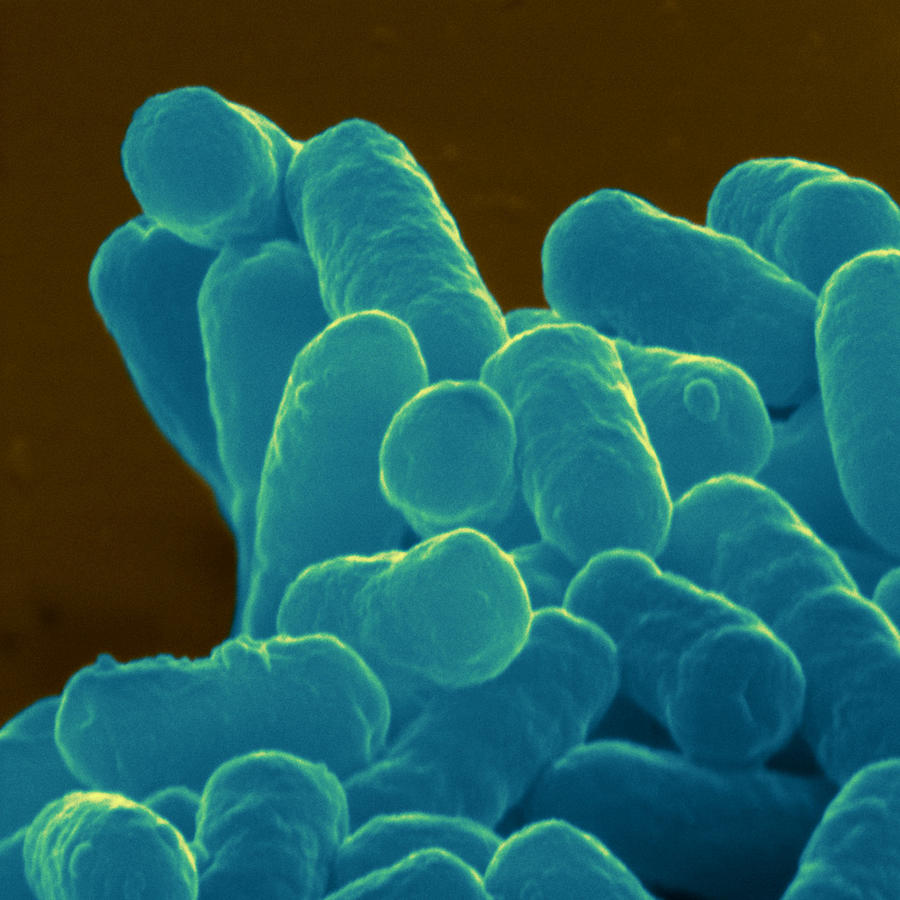 E. Coli Entero-haemorrhage Bacteria Photograph by Meckes/ottawa