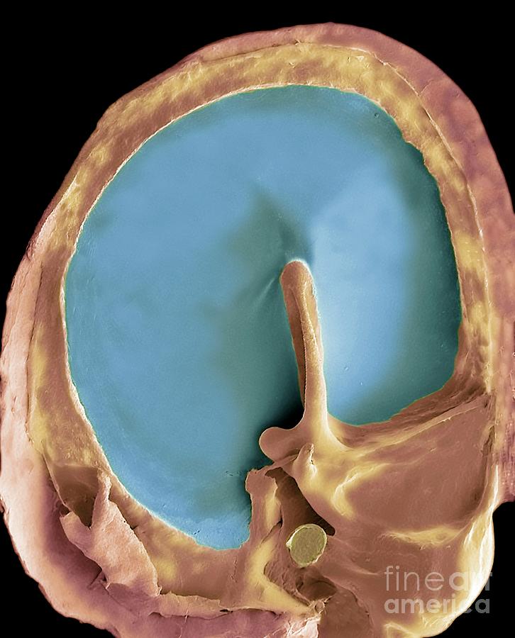 Eardrum Photograph by Steve Gschmeissner/science Photo Library | Pixels