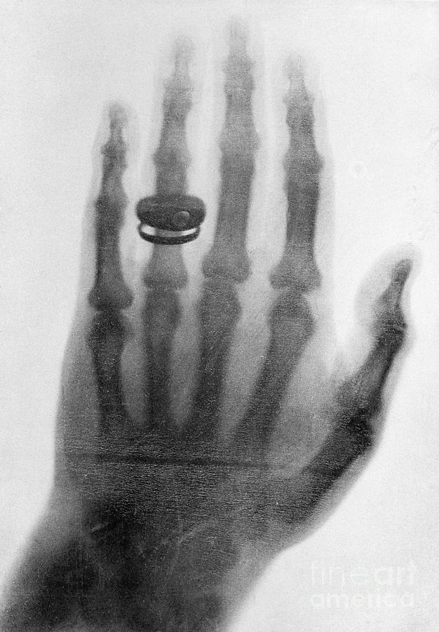 Early X-ray Of Hand Photograph by Bettmann