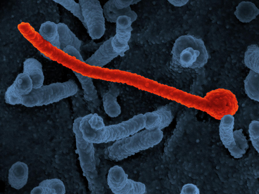 Ebola Virus Makona, Sem Photograph by Science Source