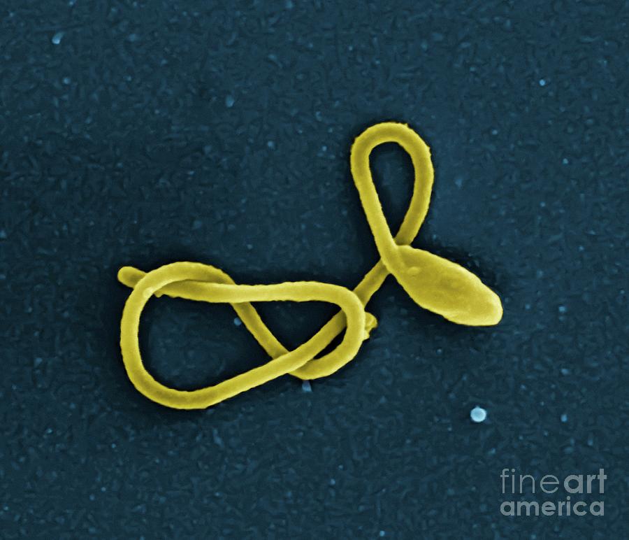 Ebola Virus Particle Photograph by National Institute Of Allergy And Infectious Diseases, National Institutes Of Health/science Photo Library