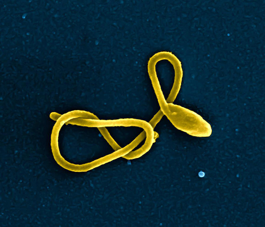 Ebola Virus Particle, Sem Photograph by Science Source