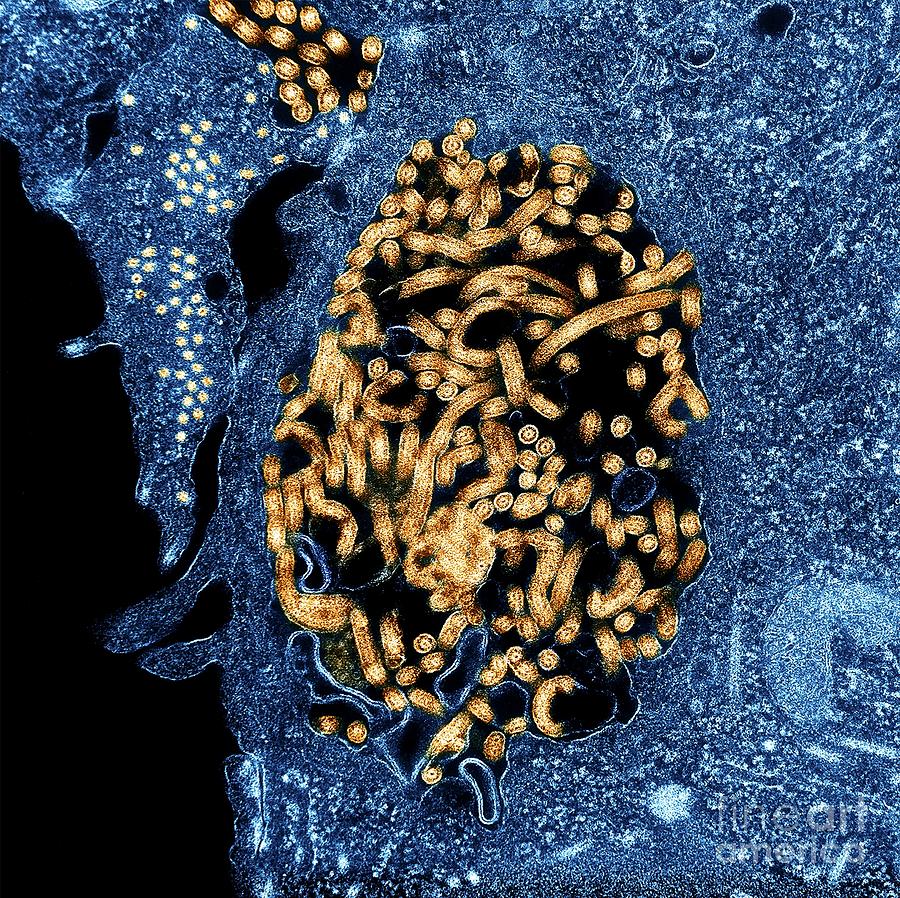 Ebola Virus Particles In Infected Tissue Photograph by National Institute Of Allergy And Infectious Diseases, National Institutes Of Health/science Photo Library