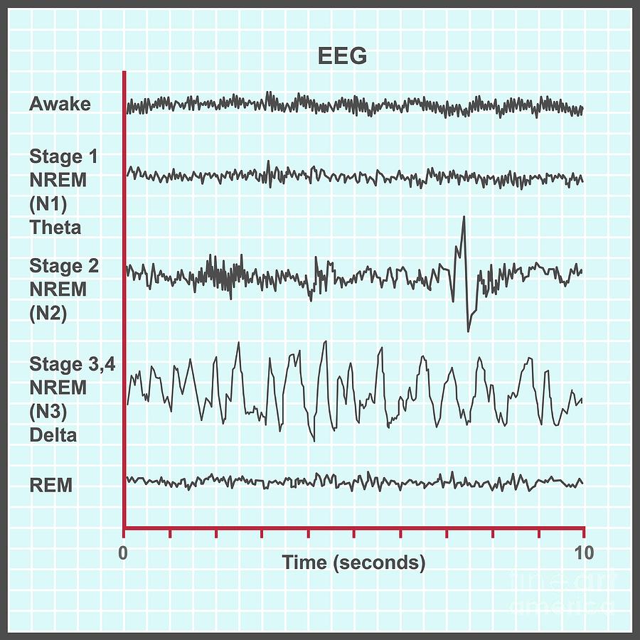 Eeg Sleep Stages Photograph by Cordelia Molloy/science Photo Library