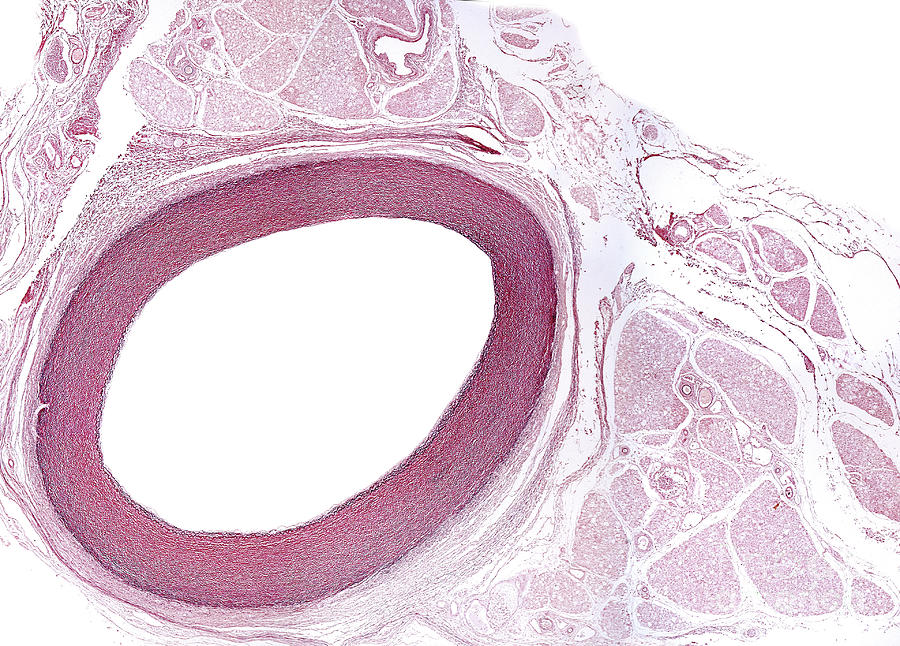 Elastic Artery Photograph by Jose Calvo / Science Photo Library Fine Art America