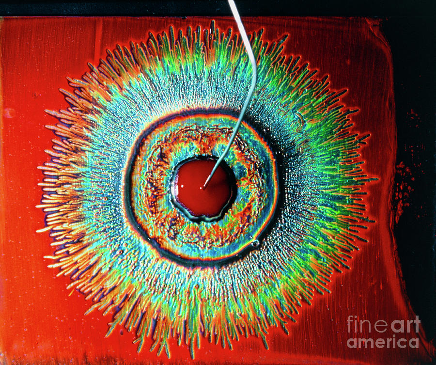 Electrical Field Blood Test Showing Normal Blood Photograph by Alfred Benjamin/science Photo Library