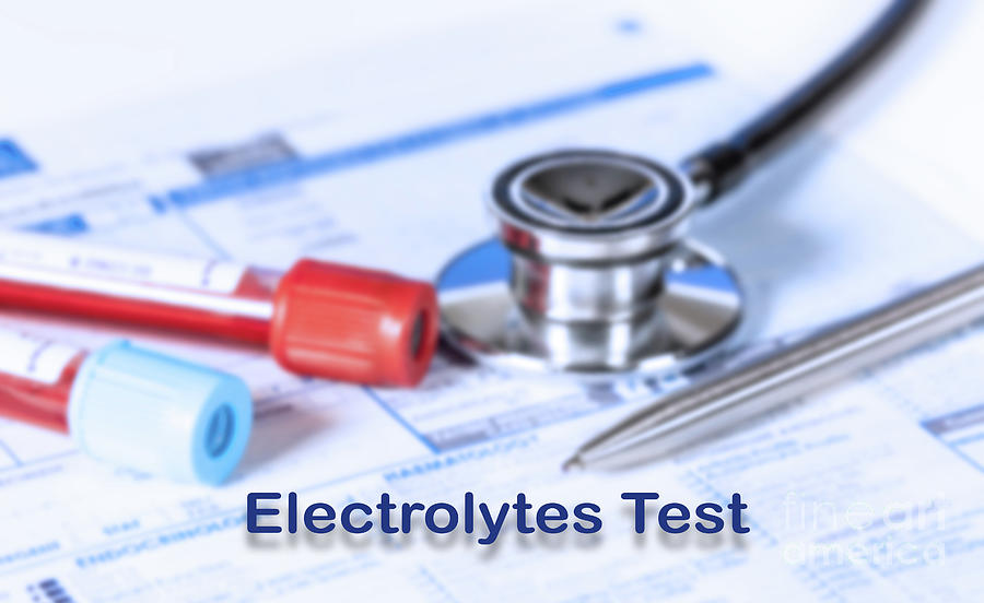 Electrolytes Test Photograph by Wladimir Bulgar/science Photo Library ...