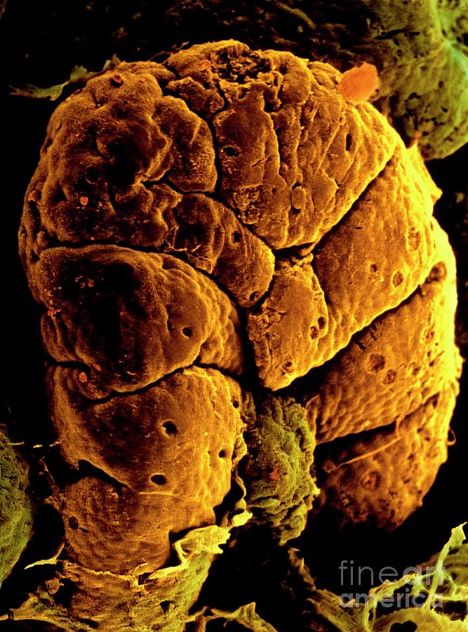 Electron Micrograph Of Villus In Small Intestine Photograph by Photo Insolite Realite/science Photo Library