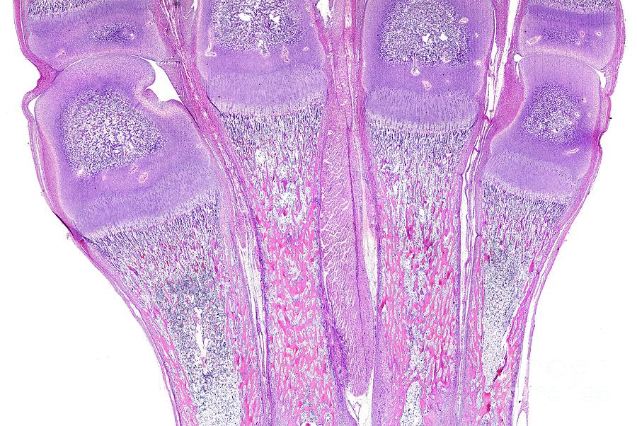 Epiphyseal Photograph - Endochondral Ossification by Jose Calvo / Science Photo Library