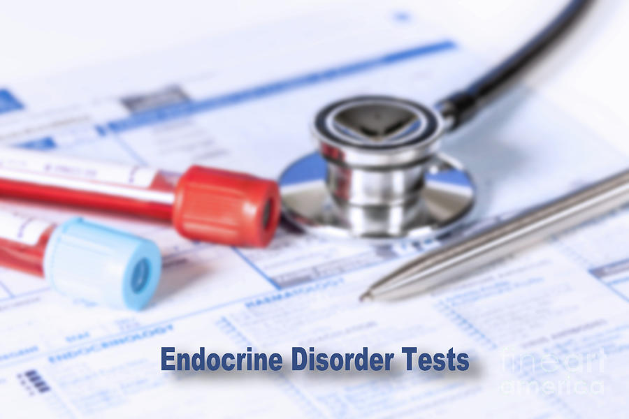 Endocrine Disorder Test Photograph By Wladimir Bulgar/science Photo ...