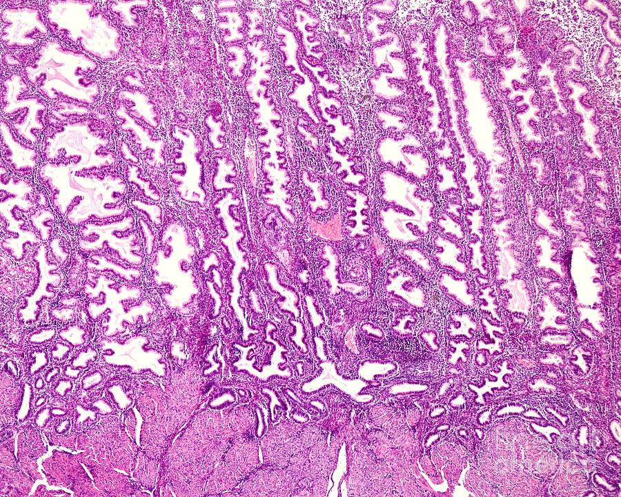 Endometrium In Secretory Phase Photograph by Jose Calvo / Science Photo Library