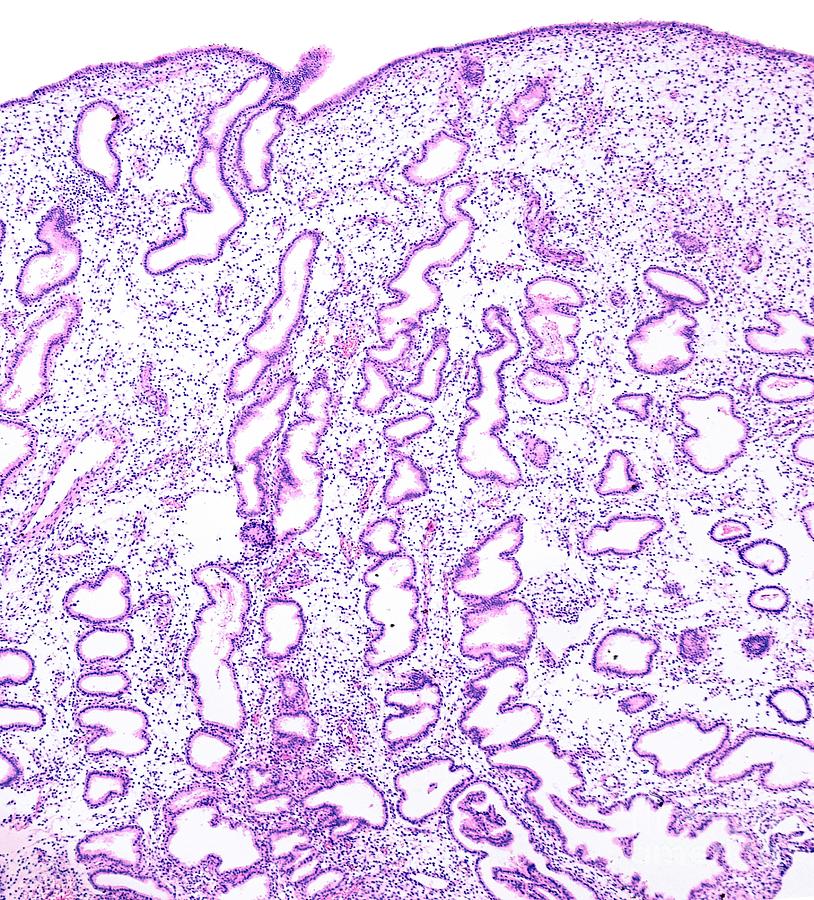 Endometrium In Secretory Phase By Jose Calvoscience Photo Library 