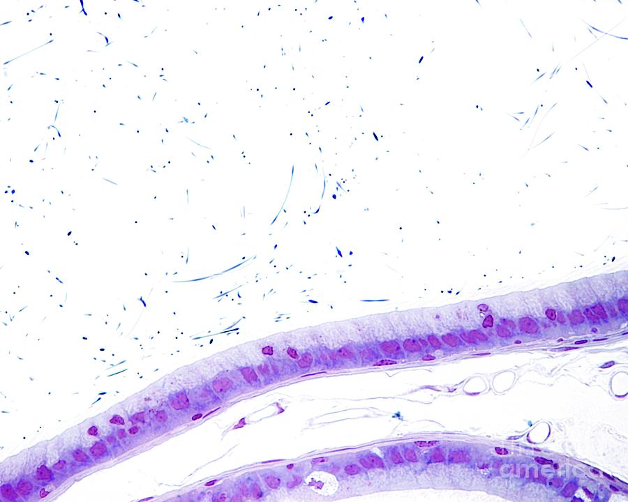 Epididymis Epithelium Photograph By Jose Calvo Science Photo Library