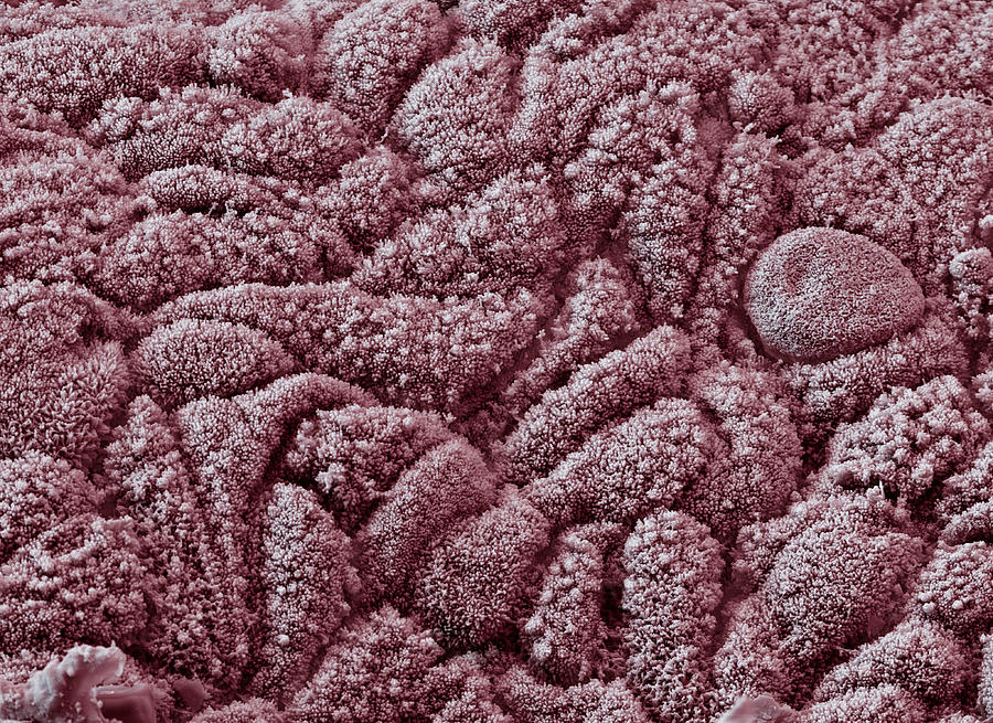 Epithelial Cells, Sem Photograph by Meckes/ottawa