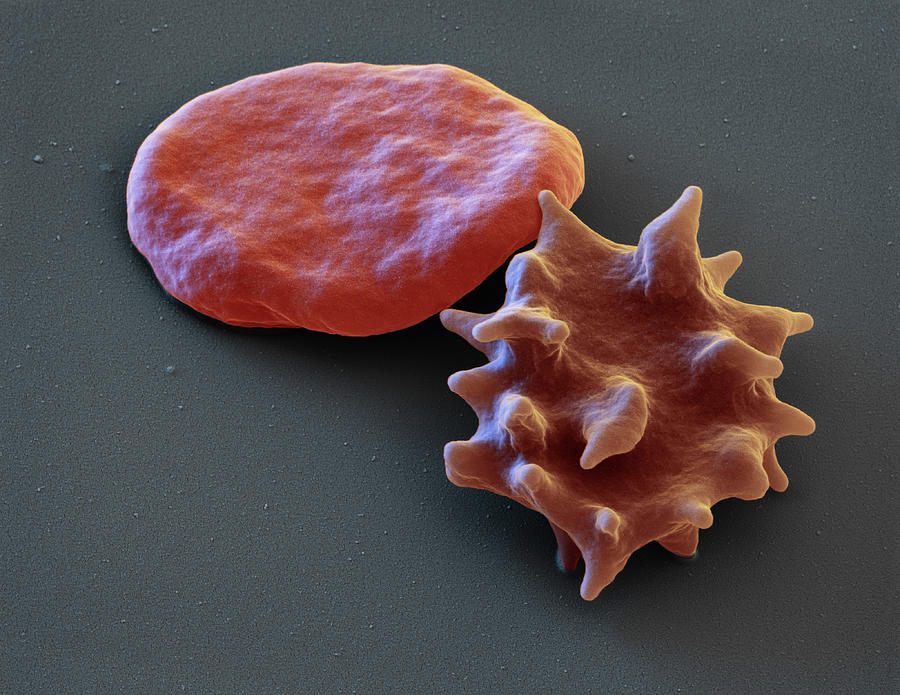 Erythrocyte And Echinocyte, Sem Photograph by Eye Of Science
