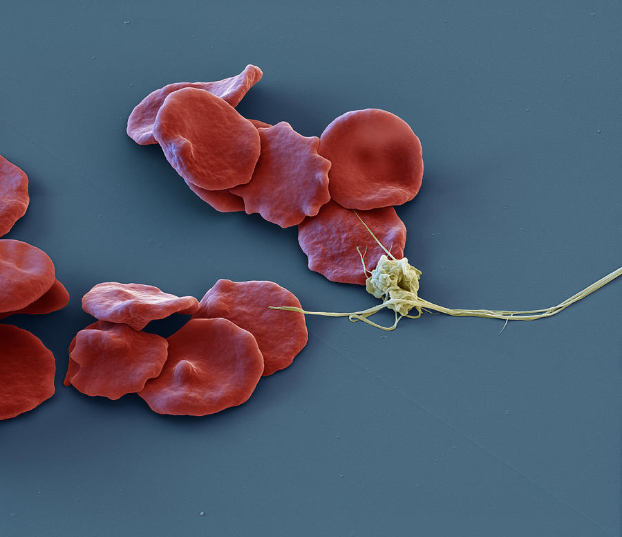 Erythrocytes And Thrombocytes, Sem Photograph by Meckes/ottawa
