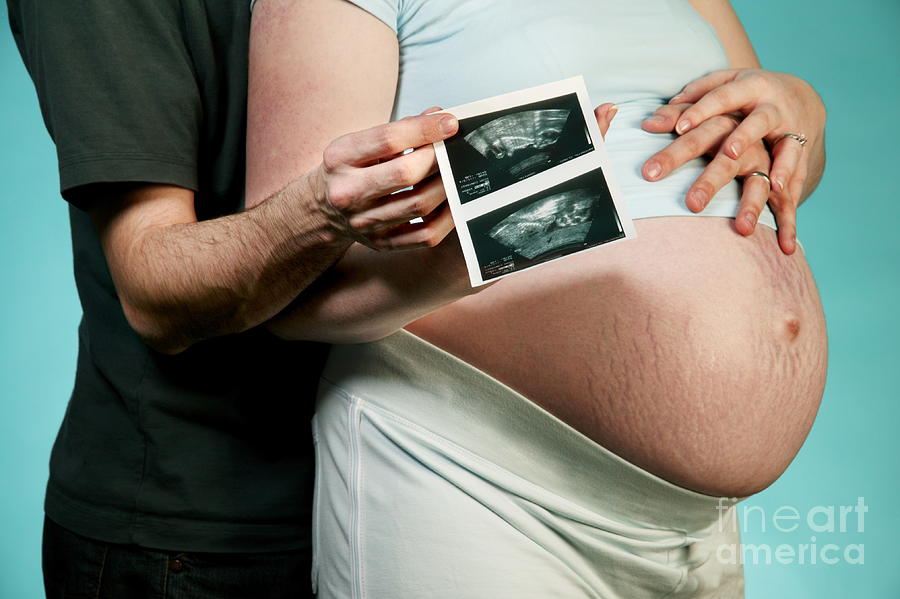 Expectant Parents Photograph by Samuel Ashfield/science Photo Library