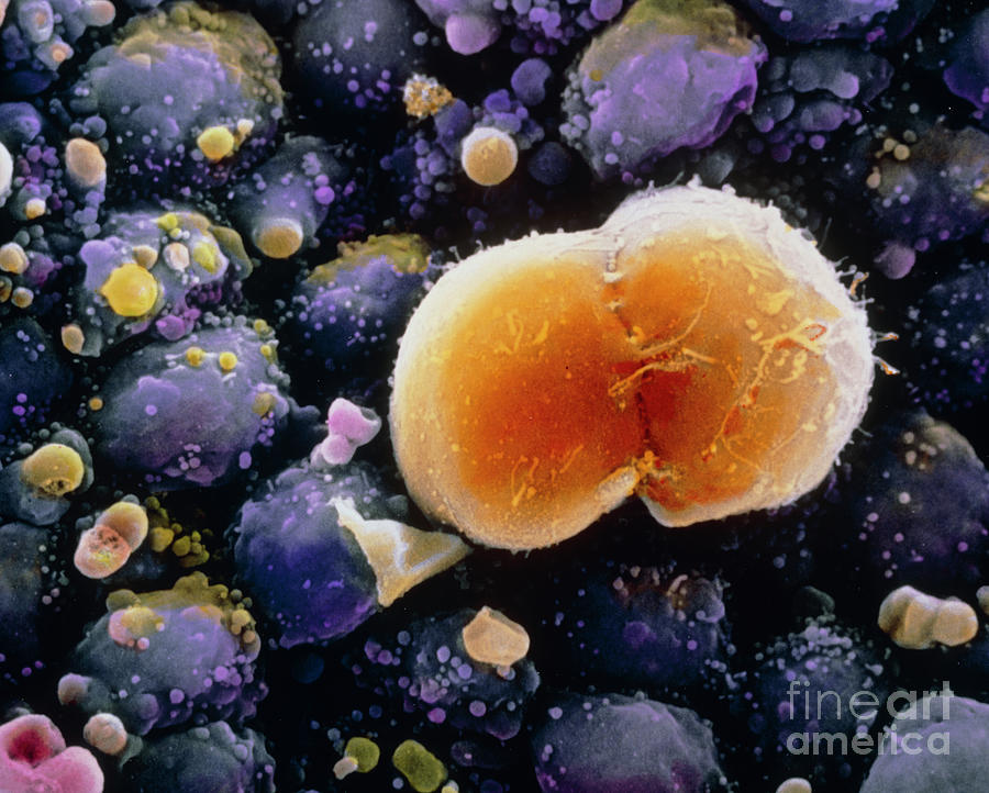 F. Colour Sem Of A Dividing Primordial Germ Cell by Professors P.m ...