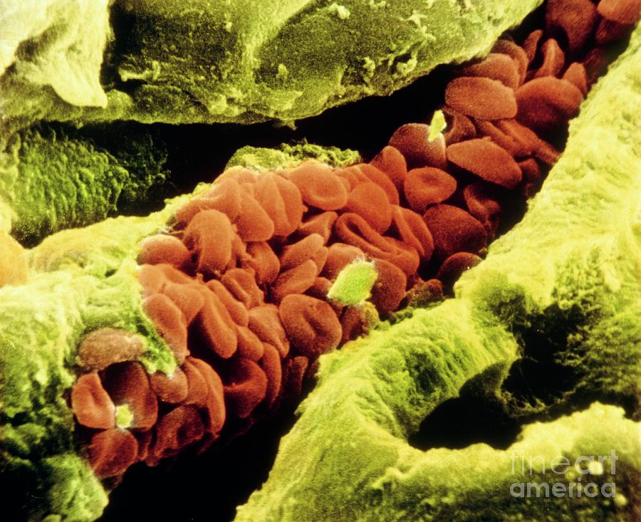 False-col Sem Of Blood Cells In A Blood Capillary Photograph by Photo Insolite Realite/science Photo Library