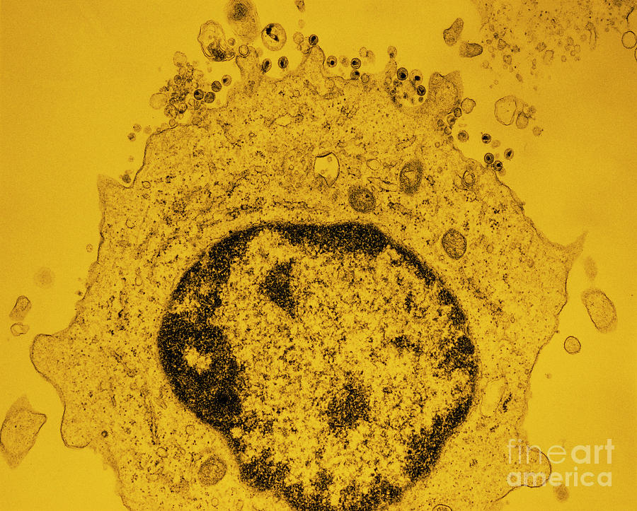 False-col Tem Of Hiv-2 (aids) Virus Particles Photograph by University Of Medicine & Dentistry Of New Jersey/science Photo Library