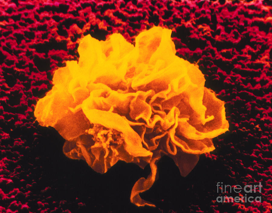 False-colour Sem Of A Migrating Macrophage Photograph by Cnri/science Photo Library