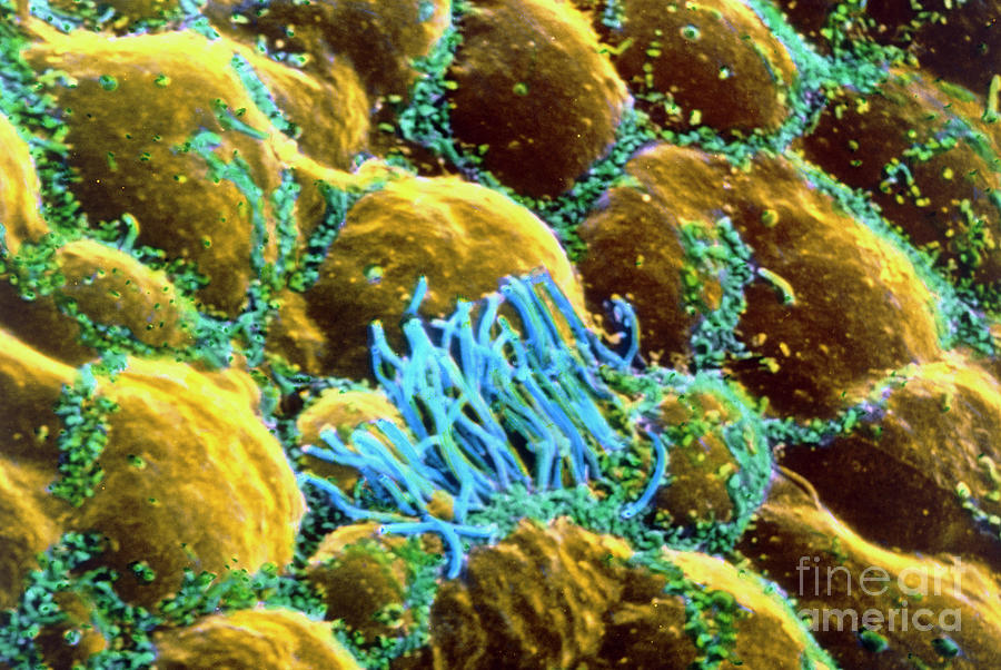 False-colour Sem Of Brain Epithelium Tissue Photograph by Professors P ...