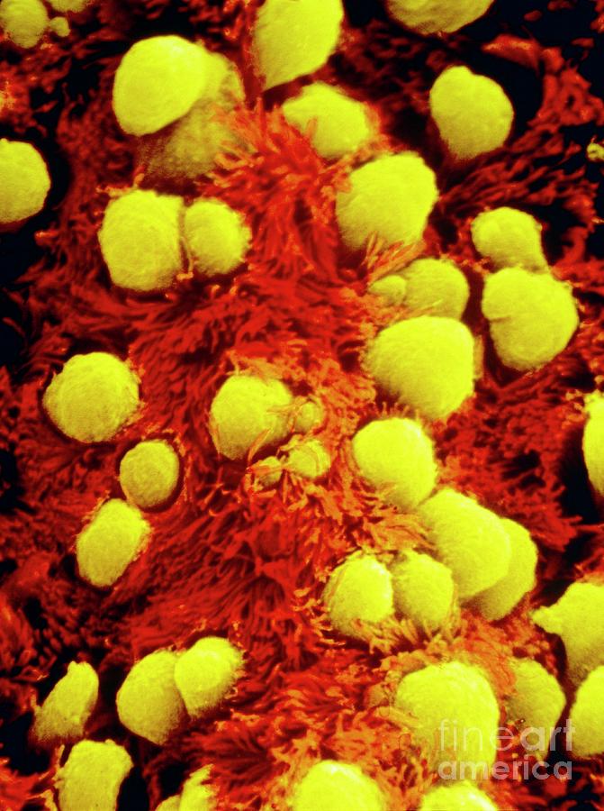 False Colour Sem Of Bronchial Epithelium Photograph By Photo Insolite Realite Science Photo