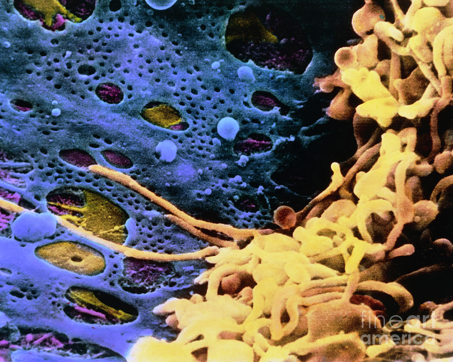 False-colour Sem Of Kupffer Cells In The Liver Photograph by Professors P.m. Motta, T. Fujita & M. Muto/science Photo Library