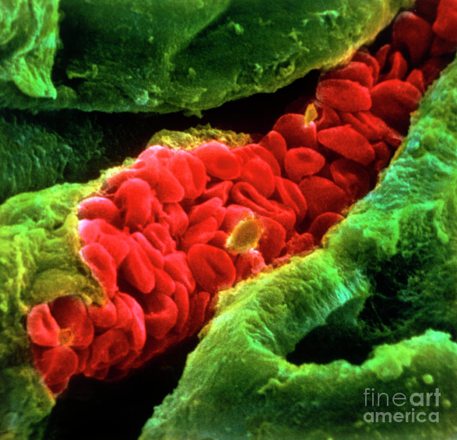 False-colour Sem Of Red Blood Cells In Capillary Photograph by Photo Insolite Realite/science Photo Library