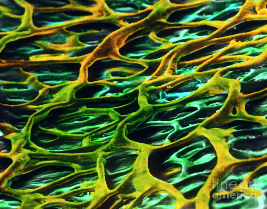 Gall Bladder Photograph - False-colour Sem Of The Wall Of The Gall Bladder by Prof. P. Motta/dept. Of Anatomy/university La Sapienza, Rome/science Photo Library