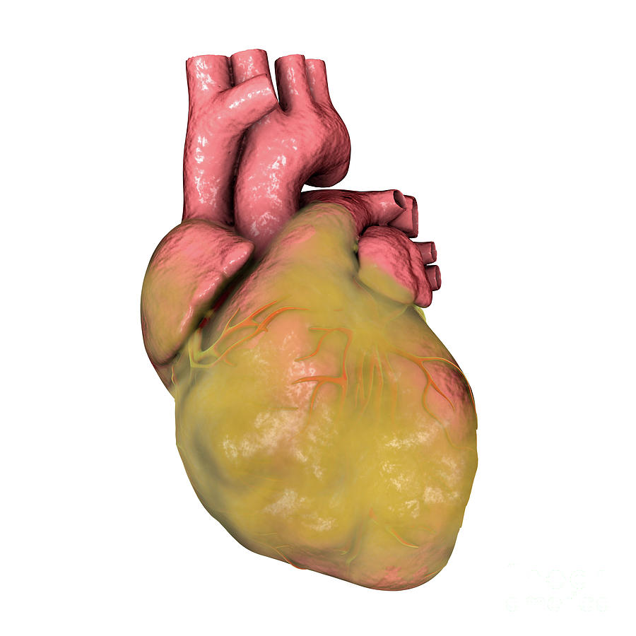 fatty-heart-photograph-by-kateryna-kon-science-photo-library-fine-art