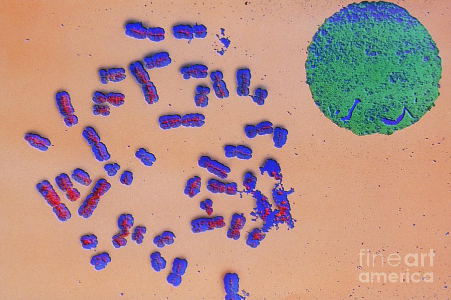 Fcolour Sem Of Full Number Of Human Chromosomes Photograph By Biophoto Associatesscience Photo 3083