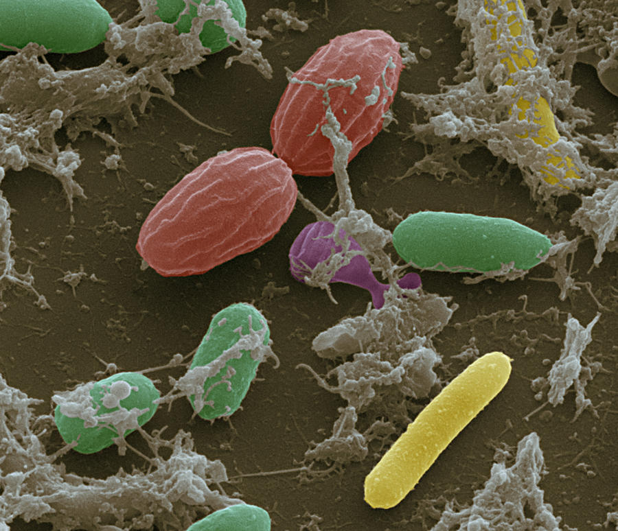 Fecal Bacteria Photograph by Meckes/ottawa