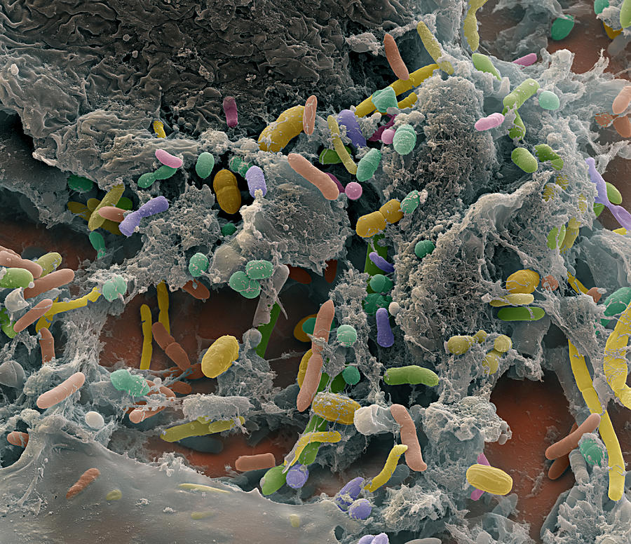 Fecal Bacteria Photograph by Oliver Meckes EYE OF SCIENCE